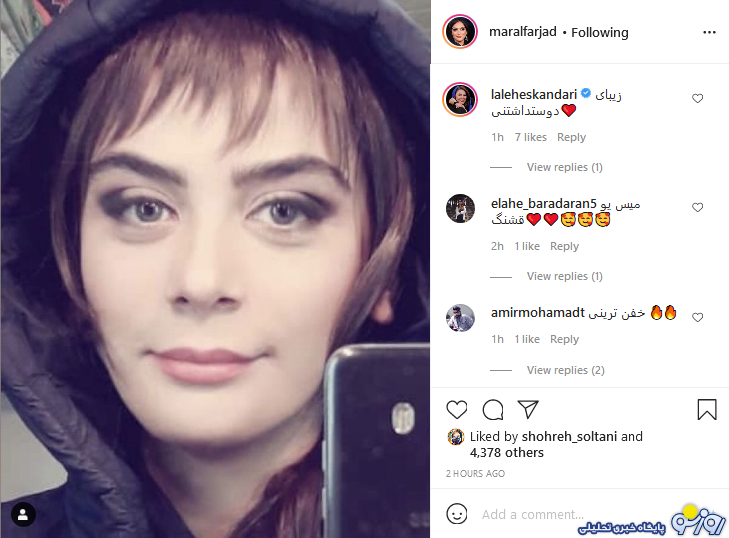 موهای چتری لنز رنگی مارال فرجاد/عکس موهای چتری لنز رنگی مارال فرجاد/عکس