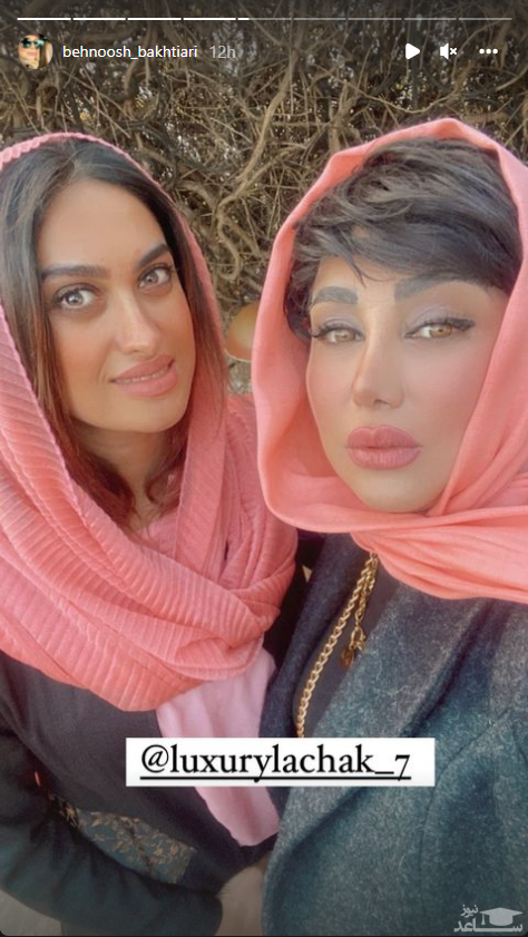 پلنگ ترین عکس از بهنوش بختیاری با تزریق ژل لب