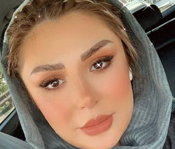 چاق شدن شدید نیوشا ضیغمی بعد از عمل! نیوشا ضیغمی