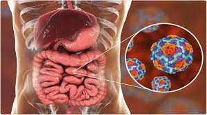 افزایش موارد ابتلا به اسهال ویروسی افزایش موارد ابتلا به اسهال ویروسی