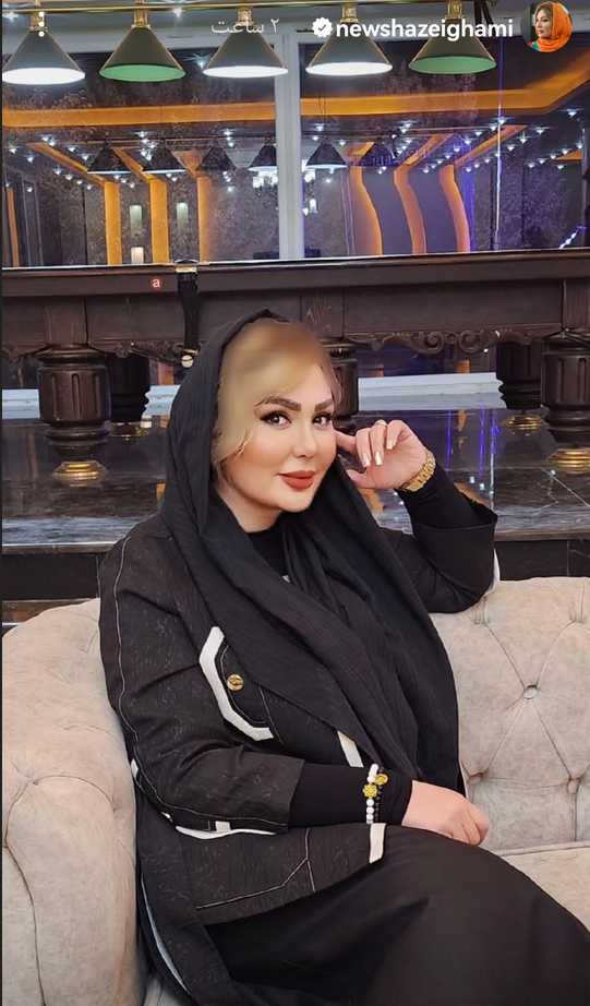 چهره مصنوعی نیوشا ضیغمی بعد از طلاق /عکس چهره مصنوعی نیوشا ضیغمی بعد از طلاق /عکس