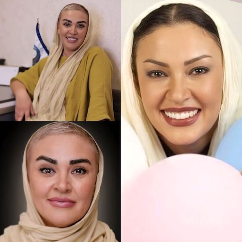 تغییر چهره غیرقابل باور ستاره سریالهای دهه هشتاد