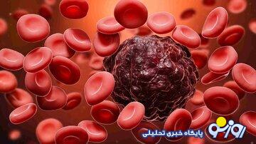 عامل خطر مهم ابتلا به سرطان خون عامل خطر مهم ابتلا به سرطان خون