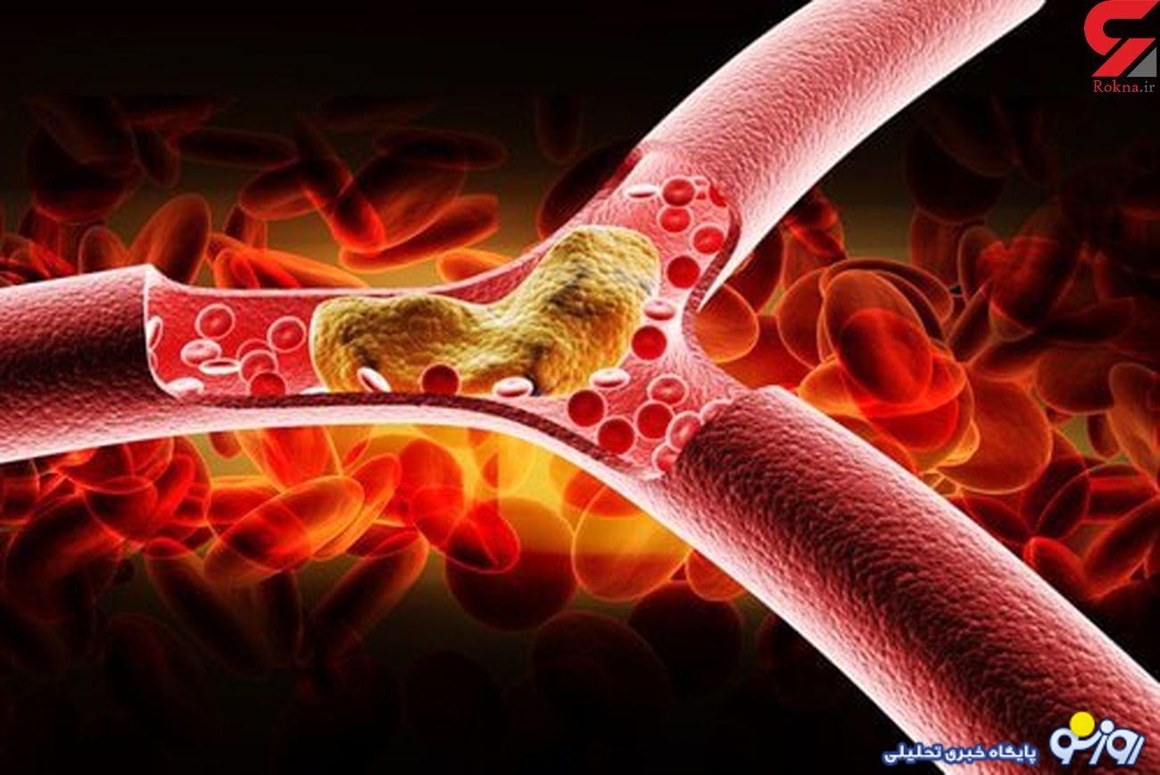 غذاهای موثر در مقابله با چربی خون چیست؟ غذاهای موثر در مقابله با چربی خون چیست؟