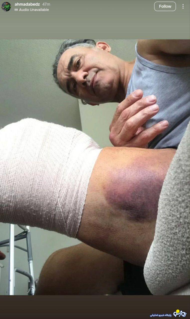 عکس دردناک از عابدزاده در آمریکا/عکی