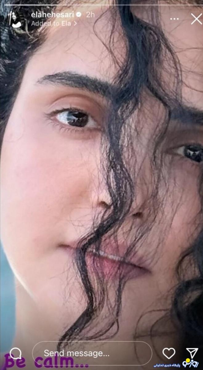 چهره بدون آرایش و متفاوت الهه حصاری در سن ۳۵ سالگی/عکس چهره بدون آرایش و متفاوت الهه حصاری در سن ۳۵ سالگی/عکس